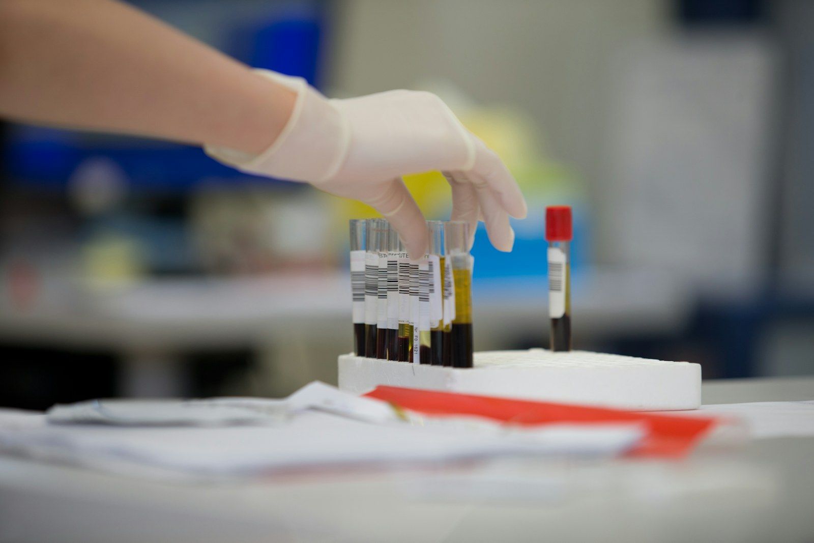 Gloved hands carefully handling labeled medical specimen tubes